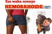 Sobanukirwa ibiteye inkeke n’amatsiko ku ndwara ya EMOROYIDE n’uko wayirinda